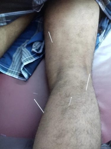 yoham physiotherapy 34